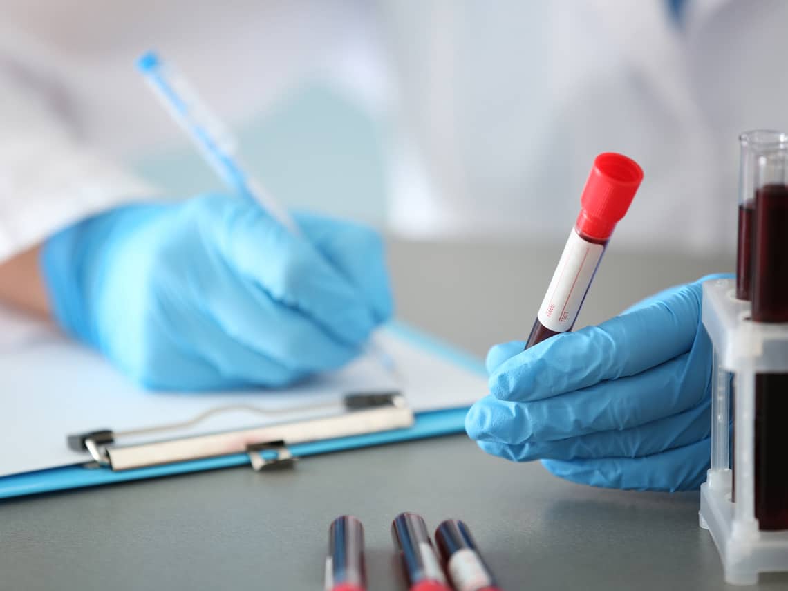 doctor examining samples for PSA tests